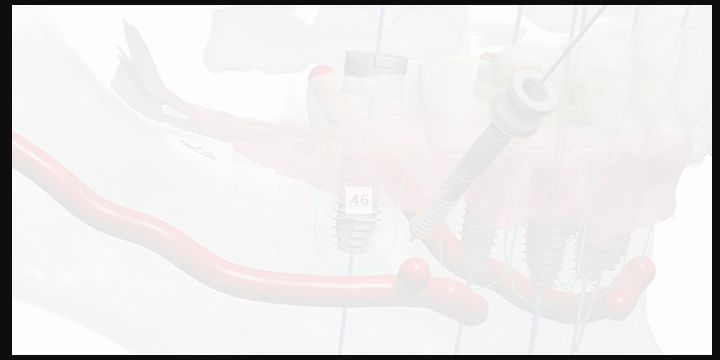 解剖结构感知规划